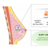 影響因子12.31！中國專家提出乳腺癌腫瘤干細(xì)胞治療開拓性研究視角